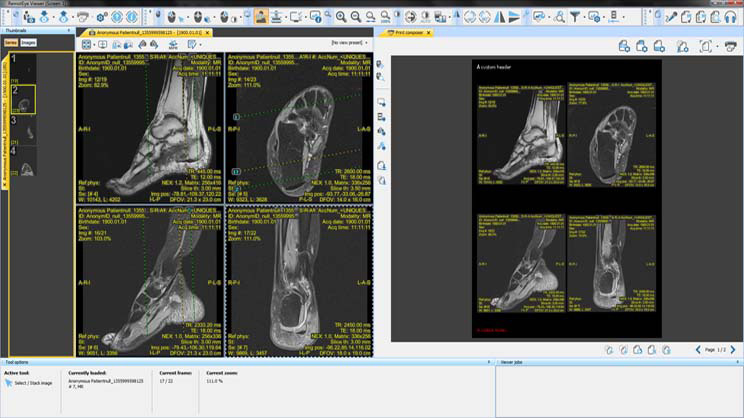 onus free dicom viewer